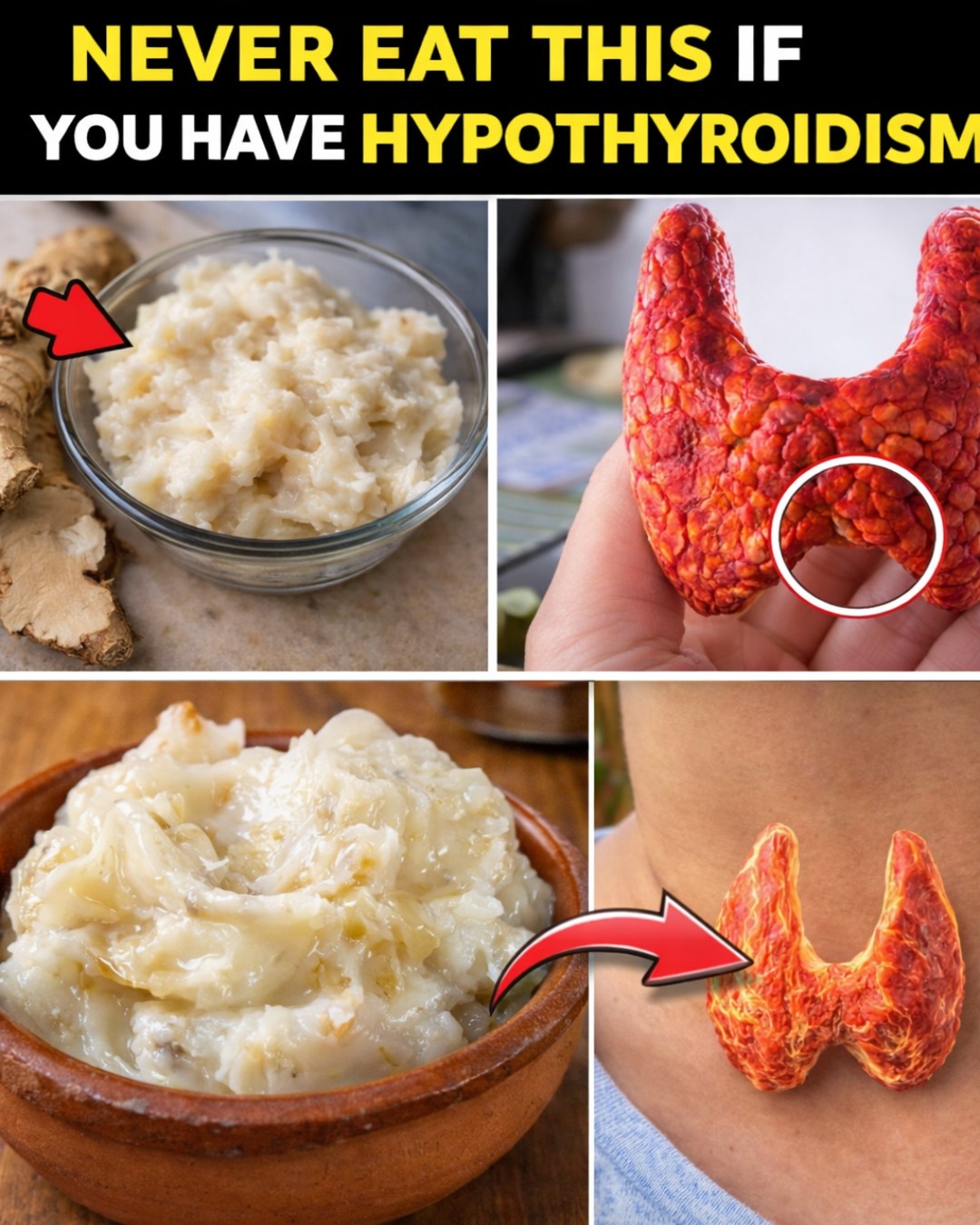 10 Everyday Foods That Could Be Quietly Sabotaging Your Thyroid – And Smart Ways to Handle Them