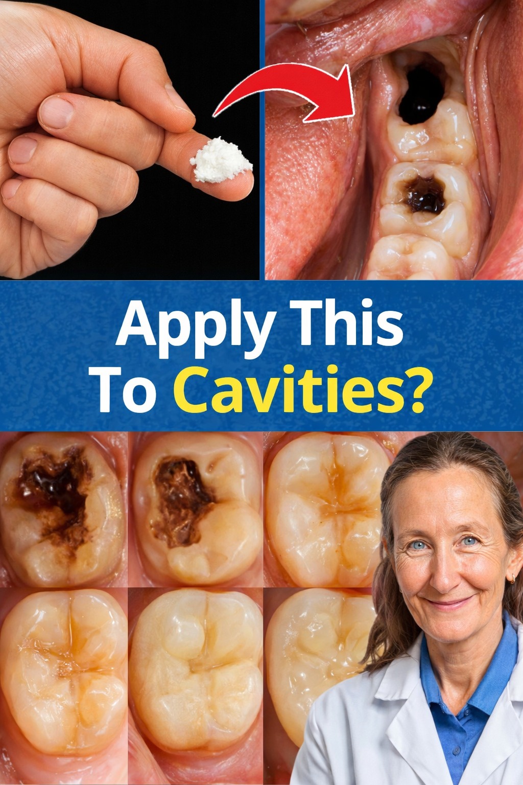 Keep These Tips in Mind to Avoid Visiting the Dentist: How to Naturally Repair a Cavity