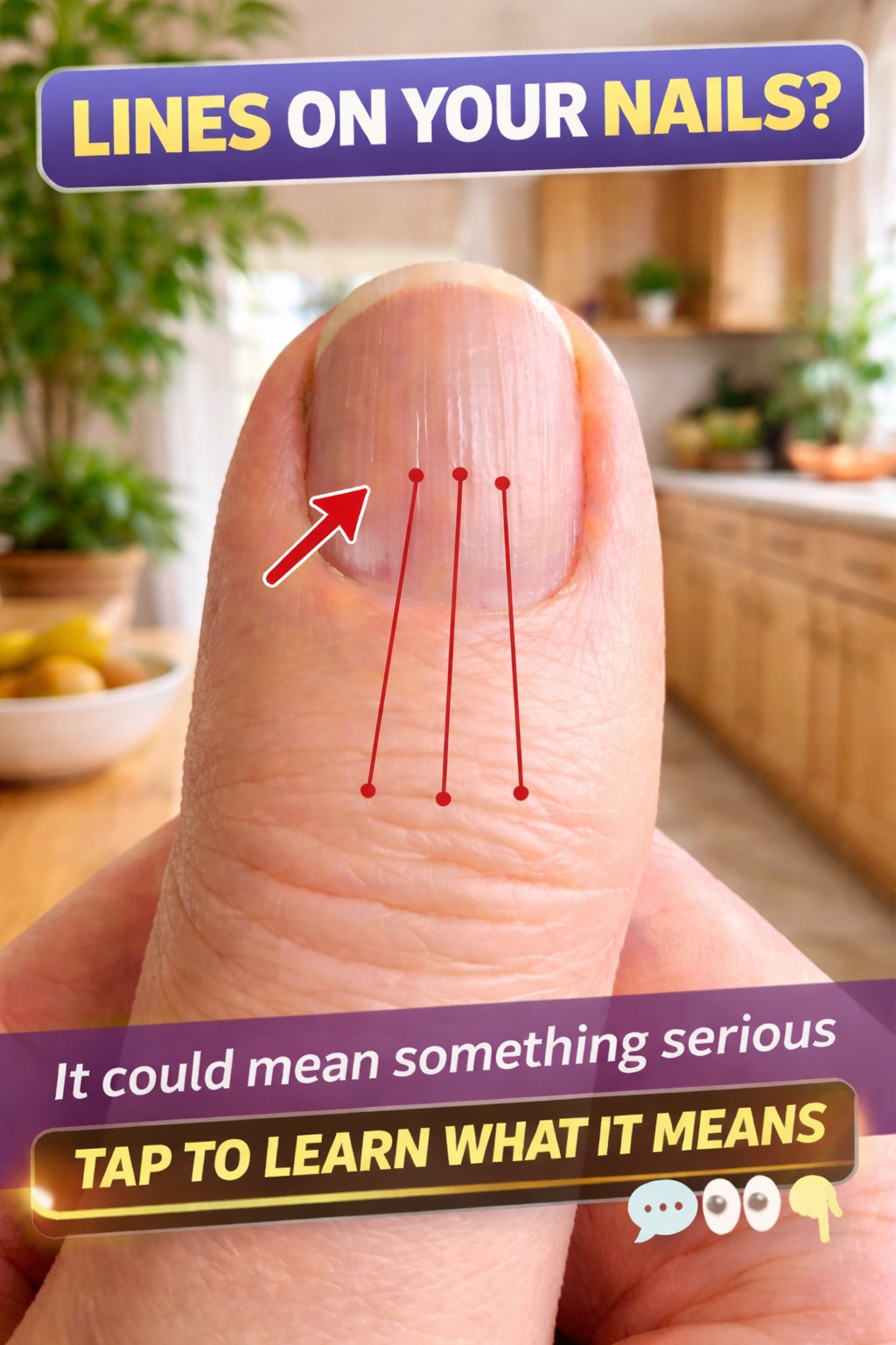 What Do Ridges on Your Nails Mean? Your Easy-to-Read Guide to Vertical, Horizontal, and Dark Lines on Fingernails