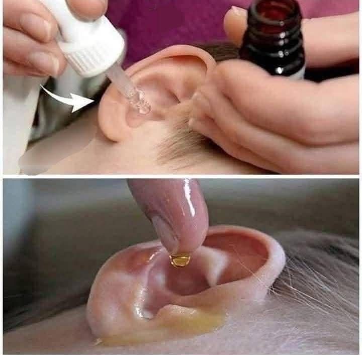 Put 2 drops in your ear and you will hear like before