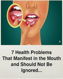 7 Health Problems That Show Up in Your Mouth You Should Never Ignore
